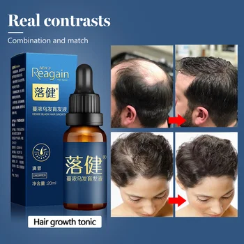 Жидкое эфирное масло для быстрого роста волос Питает кожу головы Средства против выпадения волос Уход за волосами для мужчин и женщин Восстановление роста волос